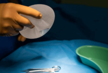 Breast Implants in Brisbane