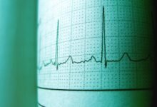 boost market pulse horizon 5405460395