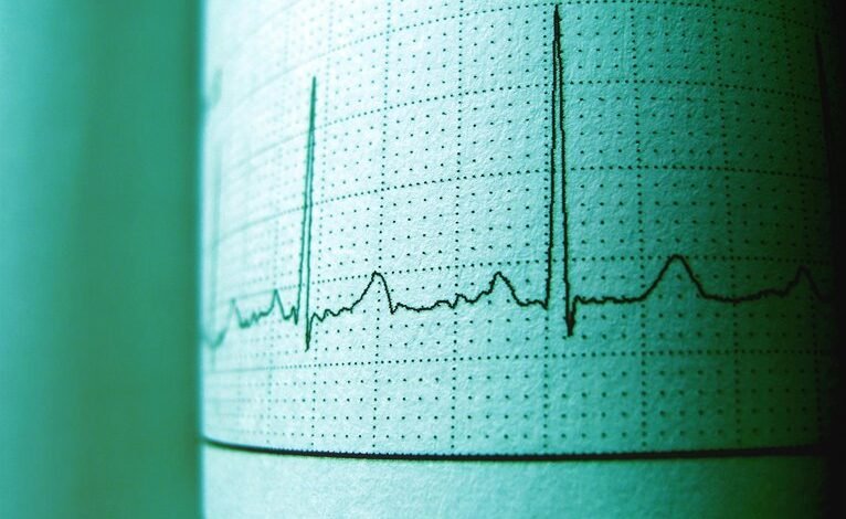 boost market pulse horizon 5405460395